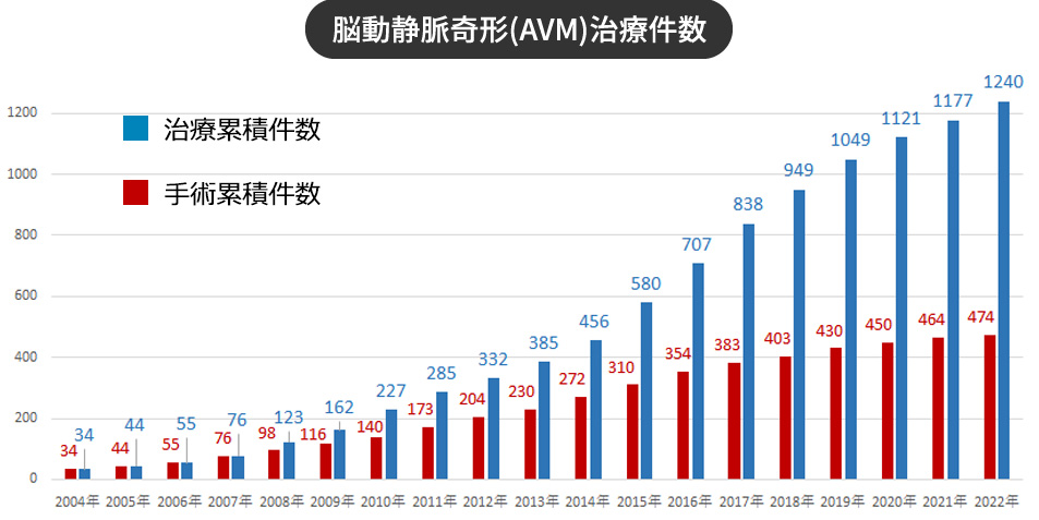AVM（脳動静脈奇形）