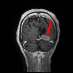 No.’26_25　手術前1