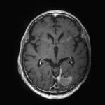 No.’26_25　手術前2