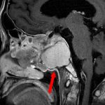 No.’26_26　手術前1