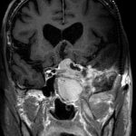 No.’26_26　手術前2