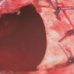 No.’26_26　摘出 後