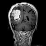 No.’25_83　手術前2