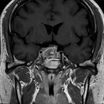 No.’26_4　手術前2