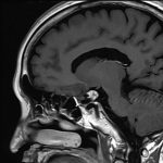 No.’25_113　手術前1