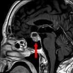 No.’25_107　手術前1
