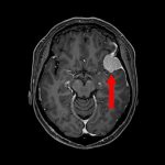 No.’26_24　手術前1