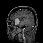 No.’26_24　手術前2
