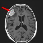 No.’26_13　手術前1