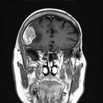 No.’26_13　手術前2