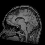 No.’25_91　手術前2