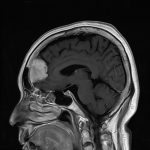 No.’26_1　手術前2