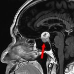 No.’25_102　手術前1