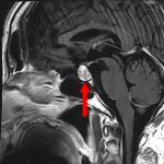 No.’25_114　手術前1