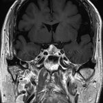No.’25_114　手術前2