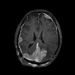 No.’26_17　手術前1