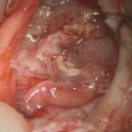 No.’26_17　摘出 前