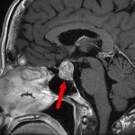 No.’26_5　手術前1