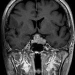 No.’26_5　手術前2