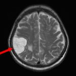No.’25_108　手術前1