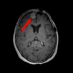 No.’25_97　手術前1