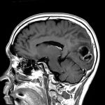 No.’25_110　手術前2
