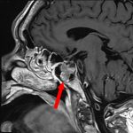 No.’25_112　手術前1