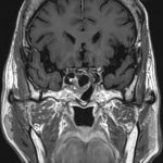 No.’25_112　手術前2