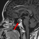 No.’25_84　手術前1