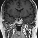 No.’25_84　手術前2