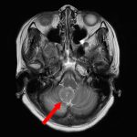 No.’25_94　手術前1