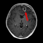 No.’26_12　手術前1