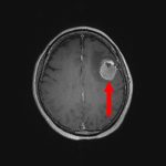 No.’25_99　手術前1