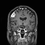 No.’25_92　手術前2