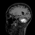 No.’25_86　手術前2