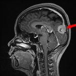 No.’25_117　手術前1