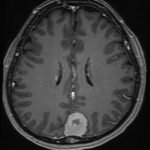 No.’25_117　手術前2