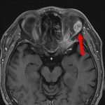 No.’25_98　手術前1