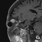 No.’25_98　手術前2