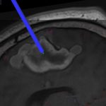 No.447　モニタリング