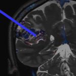 No.448　モニタリング