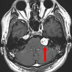 No.’25_81　手術前1