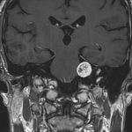 No.’25_81　手術前2