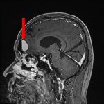 No.’25_88　手術前1