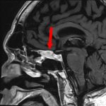No.’25_105　手術前1
