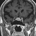 No.’25_105　手術前2