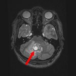 No.’25_82　手術前1