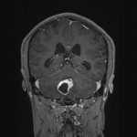 No.’25_82　手術前2