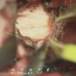 No.’25_82　摘出 後