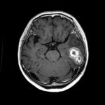 No.’25_87　手術前2